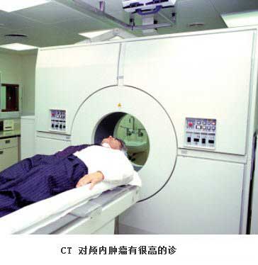 CT能检查什么病?